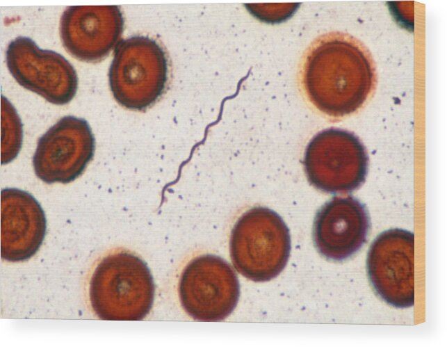 Bacteria Wood Print featuring the photograph Borrelia Burgdorferi Lm #1 by Michael Abbey