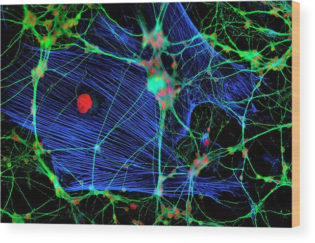 Glial Cell Wood Print featuring the photograph Glial Cells #3 by Dr Jan Schmoranzer/science Photo Library