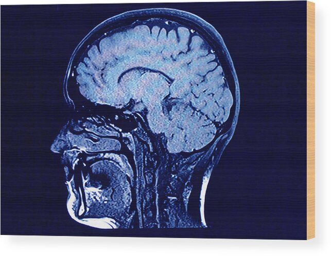 Dublin Wood Print featuring the photograph Brain head scan by Roxana Wegner