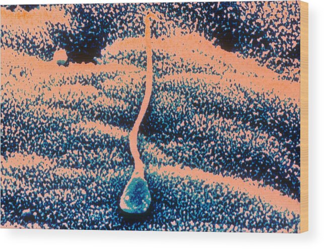 Dark Field Microscopy Wood Print featuring the photograph Human Sperm In Uterus by John Watney