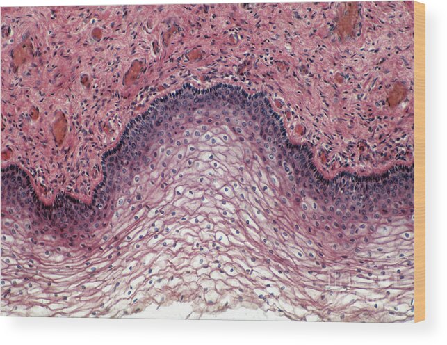 Magnified Wood Print featuring the photograph Stratified Squamous Epithelium, Lm by Tierbild Okapia