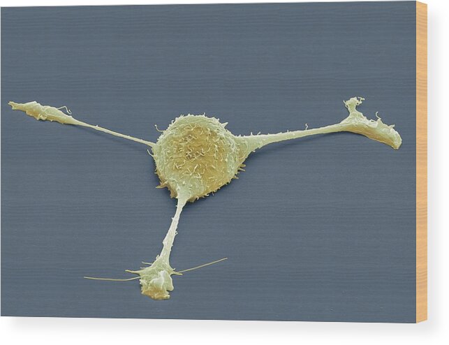 Sem Wood Print featuring the photograph Fibroblast, Sem #1 by Steve Gschmeissner