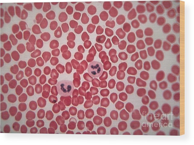 Blood Wood Print featuring the photograph Blood Smear by Eric V. Grave