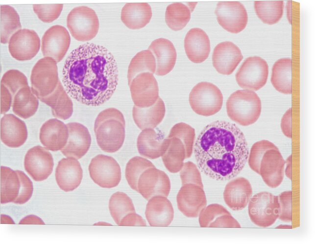 Neutrophil Polymorphs Wood Print featuring the photograph Neutrophils In Peripheral Blood Smear by M. I. Walker