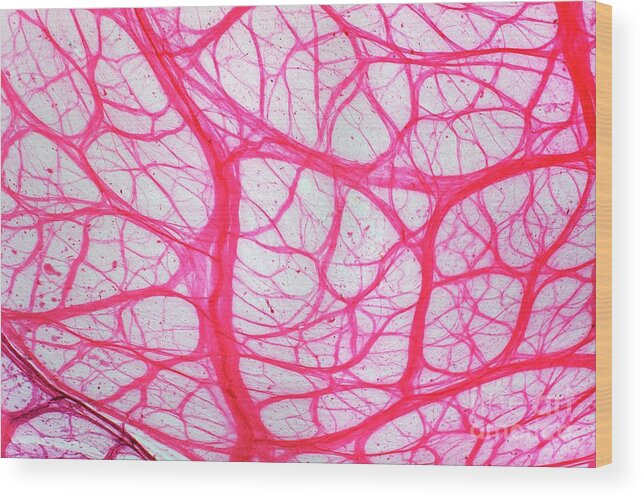 Tissue Wood Print featuring the photograph Bladder Tissue #1 by Dr Keith Wheeler/science Photo Library