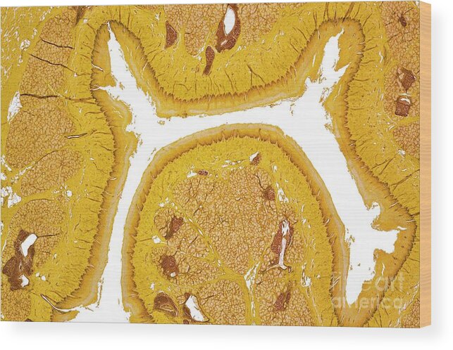 Tissue Wood Print featuring the photograph Oesophagus by Dr Keith Wheeler/science Photo Library