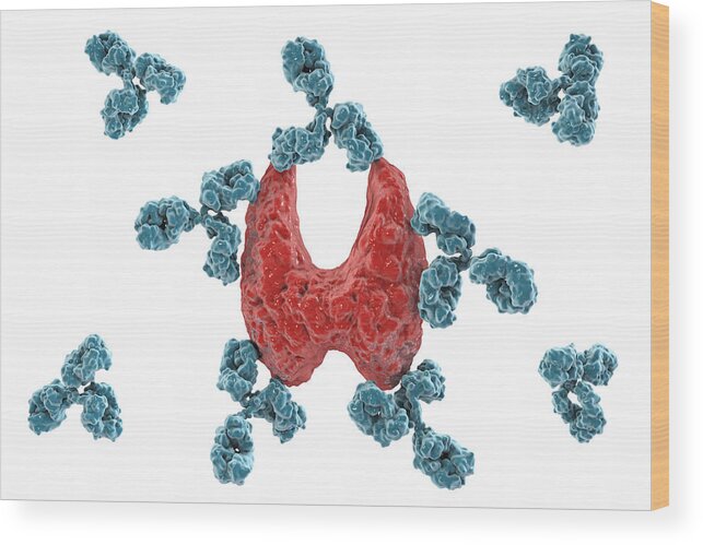 White Background Wood Print featuring the drawing Autoimmune thyroiditis, conceptual illustration #2 by Kateryna Kon/science Photo Library