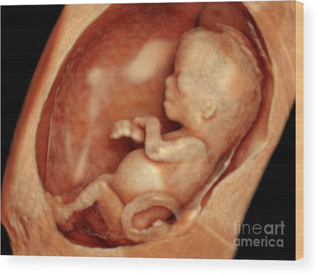 12 Week Foetus fashionable d Ultrasound