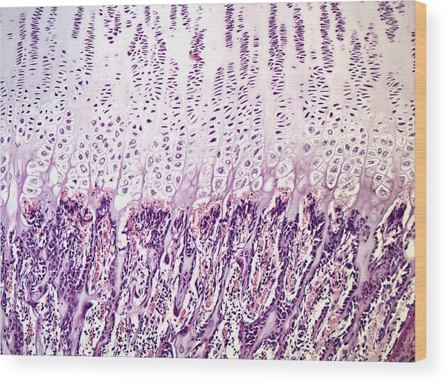 Epiphyseal Plate Wood Print featuring the photograph Endochondral Bone Development, Lm #1 by Alvin Telser