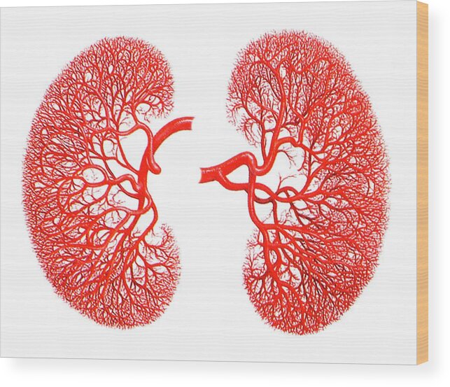 Artwork Wood Print featuring the photograph Kidneys #2 by Alfred Pasieka/science Photo Library