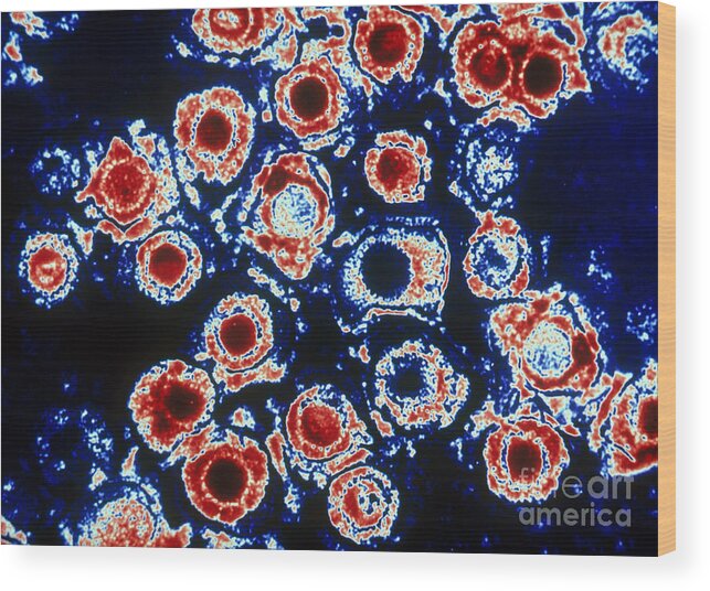 Histology Wood Print featuring the photograph Herpes Simplex Virus Tem by Scott Camazine