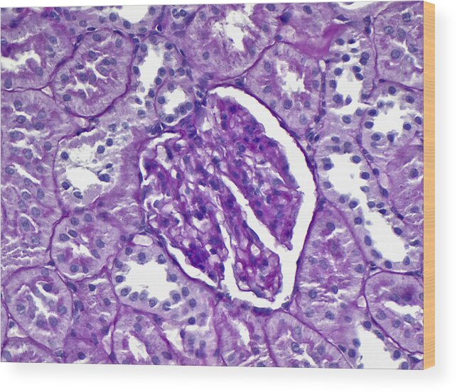 Kidney Wood Print featuring the photograph Renal Cortex Lm by Alvin Telser