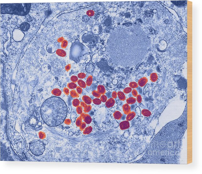 Virus Wood Print featuring the photograph Smallpox Virus, Tem #2 by Science Source