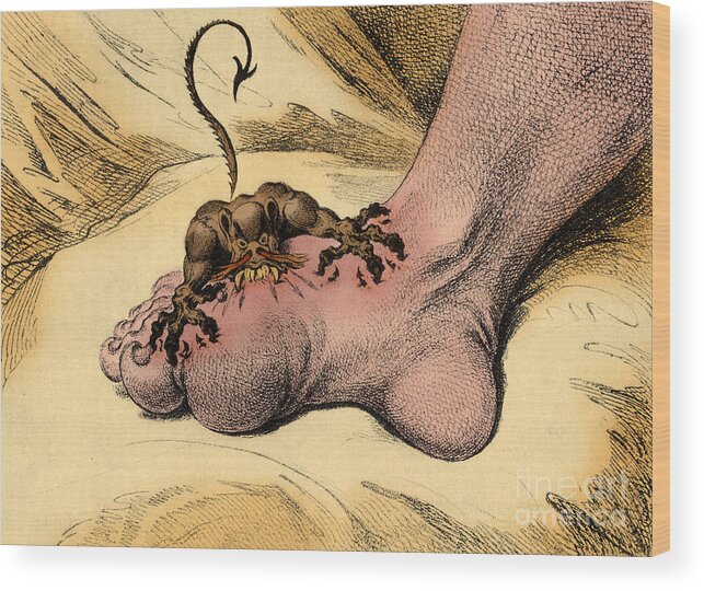 18th Century Wood Print featuring the photograph The Gout by Science Source
