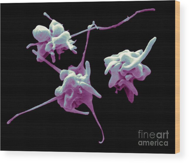 Platelets Wood Print featuring the photograph Sem Of Platelets #5 by Scimat