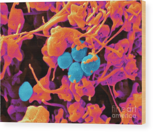 Platelets Wood Print featuring the photograph Human Platelets & Staphylococcus, Sem by Scimat