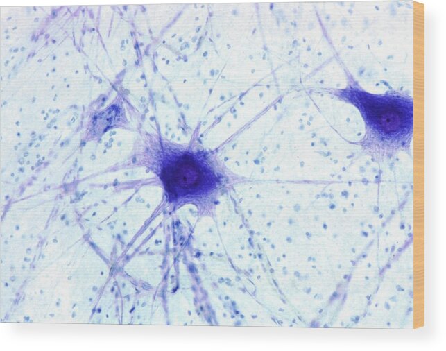 Multipolar Neuron Wood Print featuring the photograph Nerve Cells #3 by Steve Gschmeissner