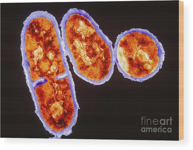 Propionibacterium Acnes Wood Print featuring the photograph Tem Propionibacterium Acnes #5 by Kwangshin Kim