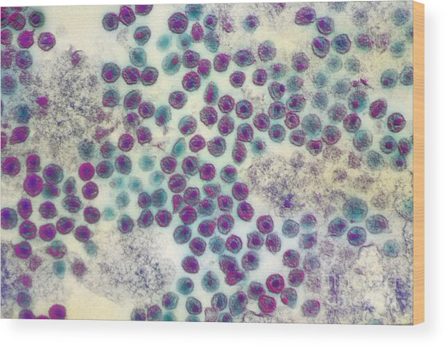 Medical Wood Print featuring the photograph Aids Virus Tem by David M. Phillips