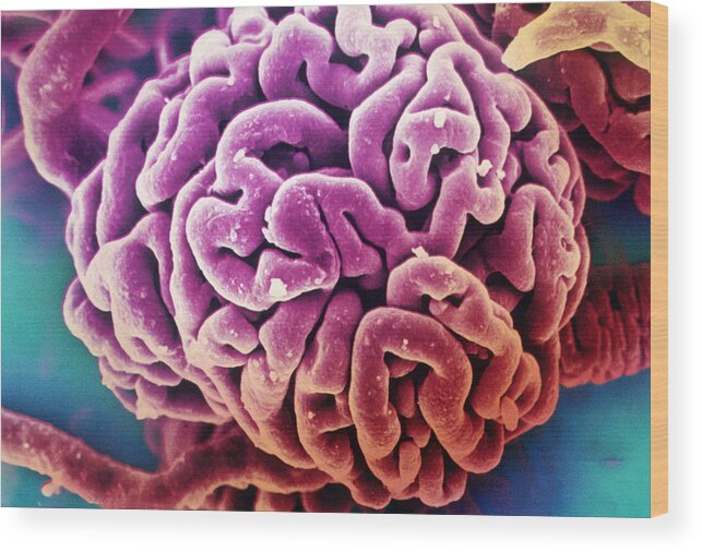 Cell Wood Print featuring the photograph Sem Of Kidney Glomeruli by John Watney