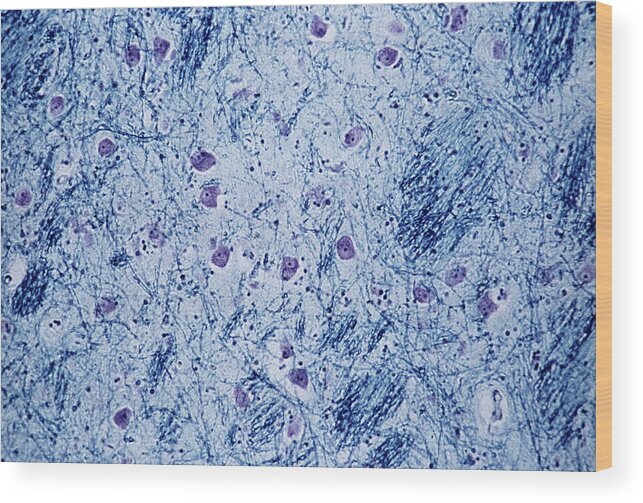 Healthy Wood Print featuring the photograph Thalamus by Cnri/science Photo Library