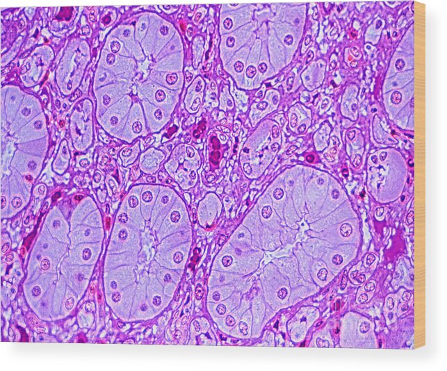 Light Microscopy Wood Print featuring the photograph Primate Kidney #1 by M. I. Walker