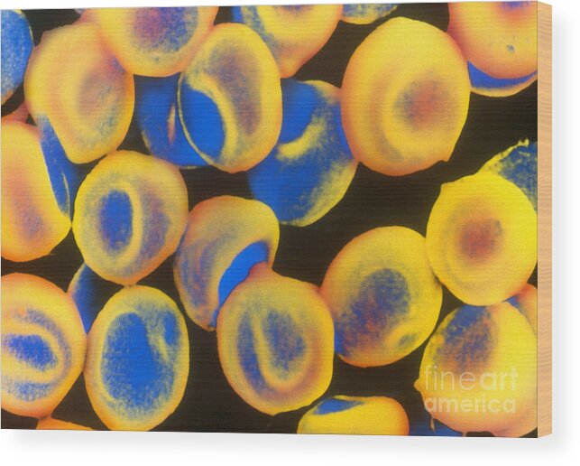 Biological Wood Print featuring the photograph Red Blood Cells, Sem #1 by Science Source