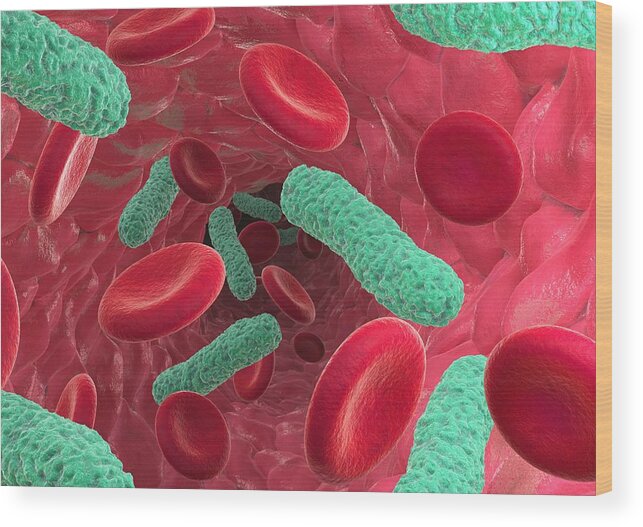 Artery Wood Print featuring the photograph Bacterial Blood Infection, Artwork by David Mack