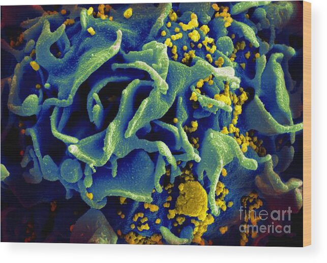 Microbiology Wood Print featuring the photograph Hiv-infected T Cell, Sem by Science Source