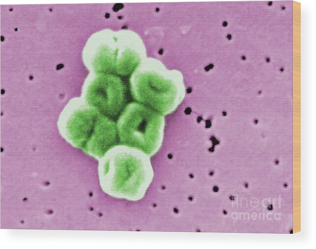 Acinetobacter Baumannii Wood Print featuring the photograph Acinetobacter Baumannii, Sem by Science Source