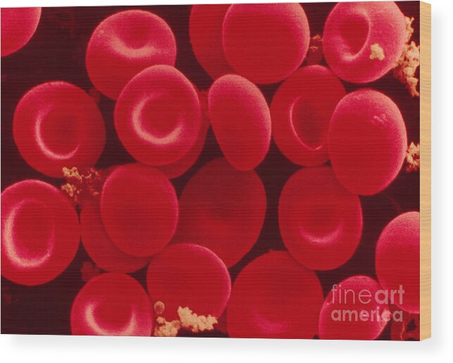 Erythrocyte Wood Print featuring the photograph Red Blood Cells by Scimat