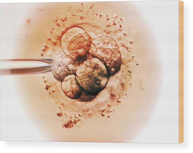 Tubing Wood Print featuring the photograph Embryo selection for IVF light micrograph #2 by Science Photo Library - ZEPHYR