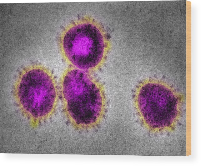 Pneumonia Wood Print featuring the photograph EM Coronavirus, causing SARS by Callista Images