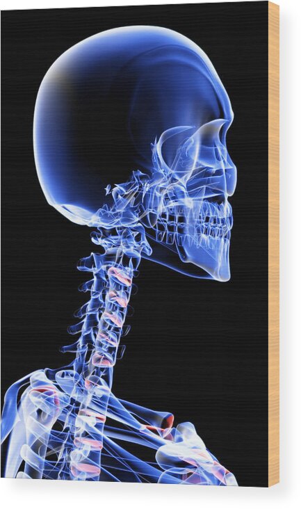 Vertical Wood Print featuring the digital art The Bones Of The Head And Neck #3 by MedicalRF.com