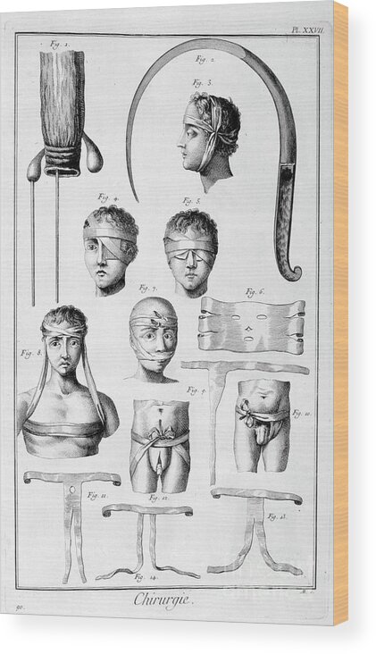 Reproductive Organ Wood Print featuring the drawing Surgery, 1751-1777 #1 by Print Collector
