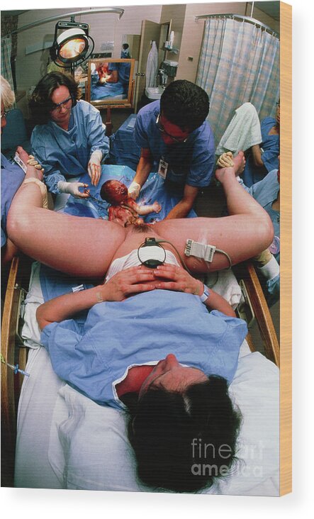 Childbirth Wood Print featuring the photograph View Of A Baby Emerging During Hospital Childbirth by David Nunuk/science Photo Library