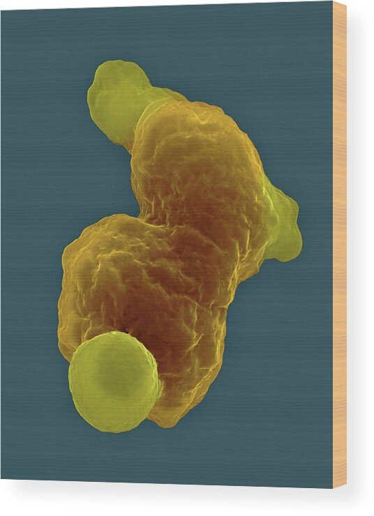 29239b Wood Print featuring the photograph Parasitic Amoeba (entamoeba Gingivalis) Sem #2 by Dennis Kunkel Microscopy/science Photo Library