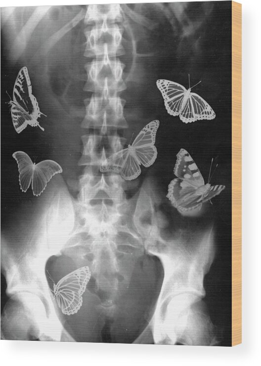Abdomen Wood Print featuring the photograph Butterflies In The Stomach by Photostock-israel