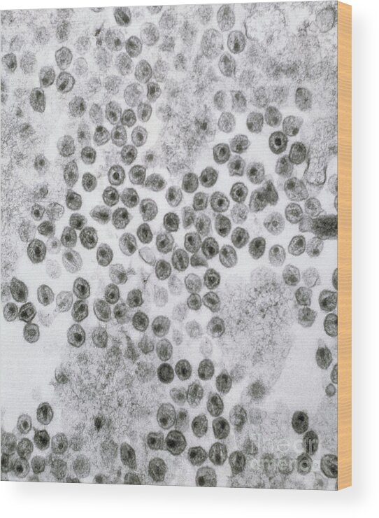 Hiv Wood Print featuring the photograph Hiv Virus by David M. Phillips