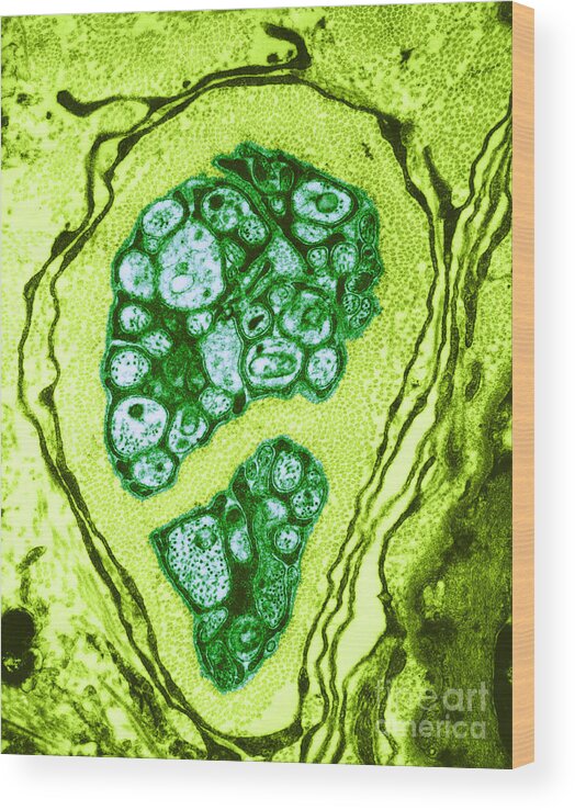 Microscopy Wood Print featuring the photograph Nerve Cell Axons, Tem by David M. Phillips