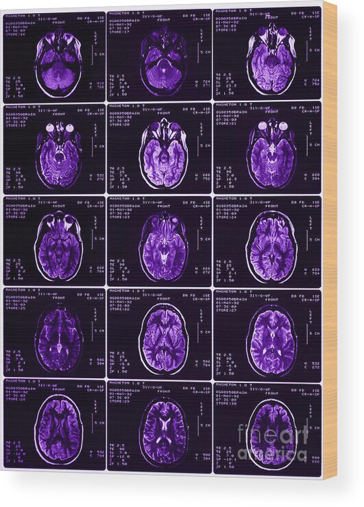 Brain Wood Print featuring the photograph Mri Of Normal Brain #27 by Science Source
