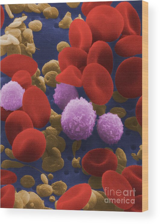 Blood Cell Wood Print featuring the photograph Human Blood Cells #1 by NIH / Science Source