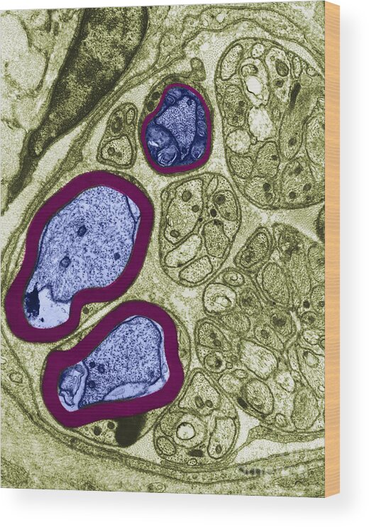Histology Wood Print featuring the photograph Axons In Rat Cell, Tem #1 by David M. Phillips