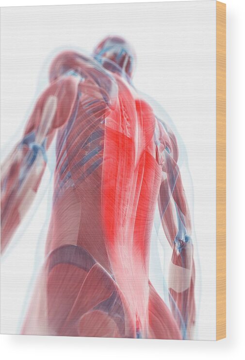 Physiology Wood Print featuring the digital art Back Pain, Conceptual Artwork #48 by Sciepro