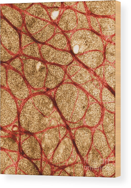 Science Wood Print featuring the photograph Epithelial Cell From Cervix, Tem by David M. Phillips