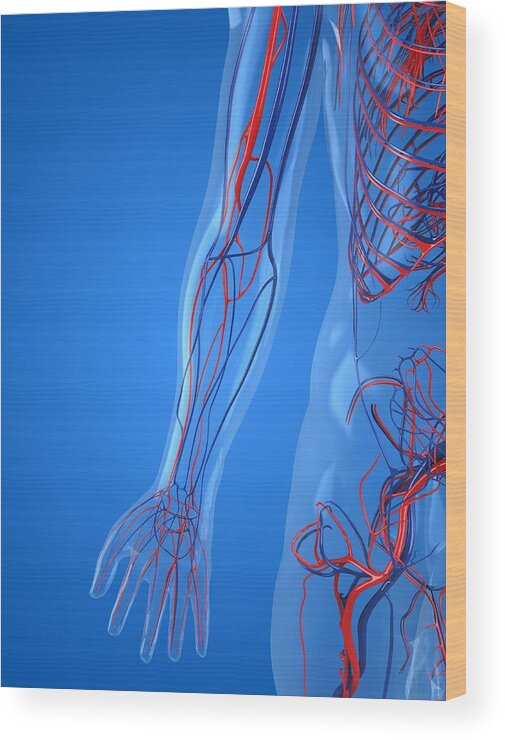 Vertical Wood Print featuring the photograph Vascular System, Artwork #10 by Sciepro