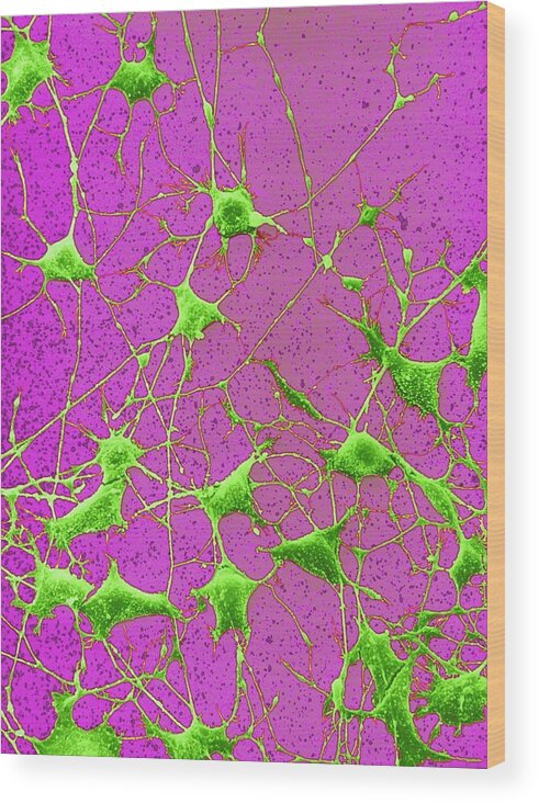 Magnified Image Wood Print featuring the photograph Nerve Cells #2 by Steve Gschmeissner