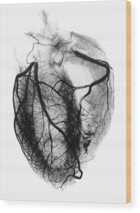 Black-and-white Wood Print featuring the photograph Coronary Arteriogram Of Arteries Of The Heart 1904 by Science Photo Library