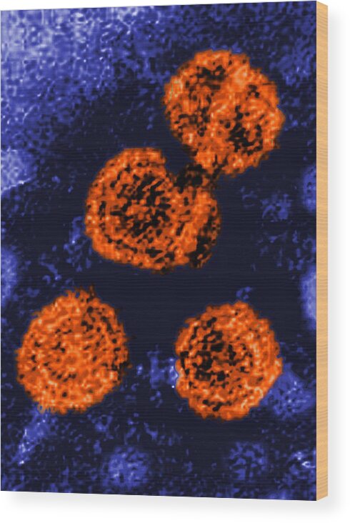 Science Wood Print featuring the photograph Hepatitis B Virus, Sem by Science Source