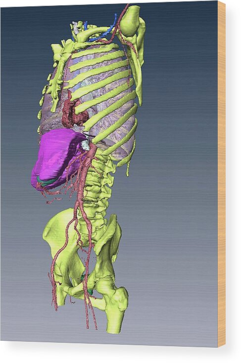 Bone Wood Print featuring the photograph Torso Skeleton And Organs by D & L Graphics